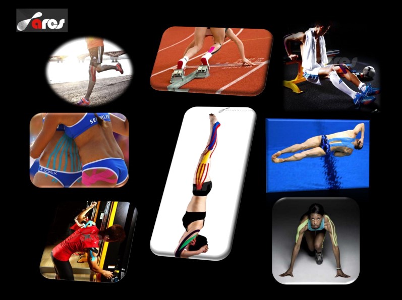 Использование кинезио тейпирования в спорте Использование кинезио тейпирования в спорте