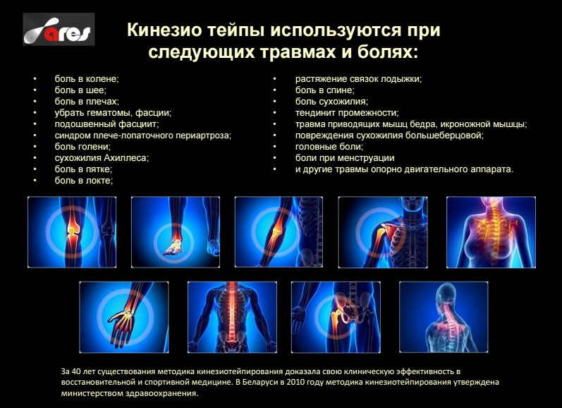 При каких травмах и болях используются кинезио тейпы При каких травмах и болях используются кинезио тейпы